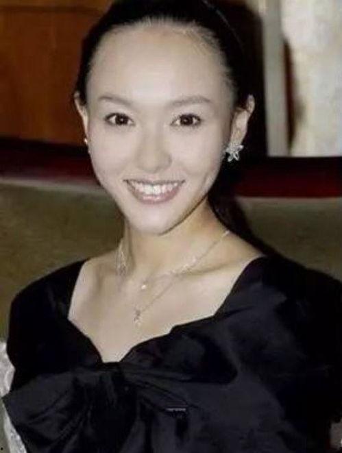 明星秃头美女,明星美女生发秘籍大公开